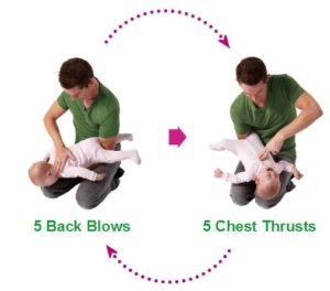 how to treat a choking infant